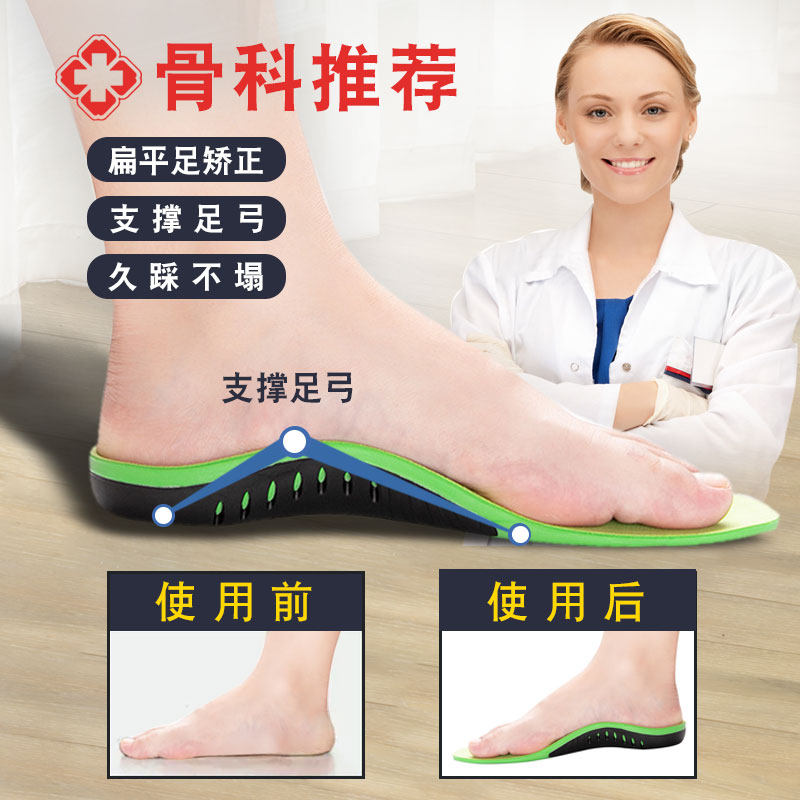冬季扁平足鞋垫足弓矫正外八字足外翻男女儿童通用成人支撑平底足,服饰配件/皮带/帽子/围巾,鞋垫,淘宝优惠券,粉丝福利购,淘宝优惠卷