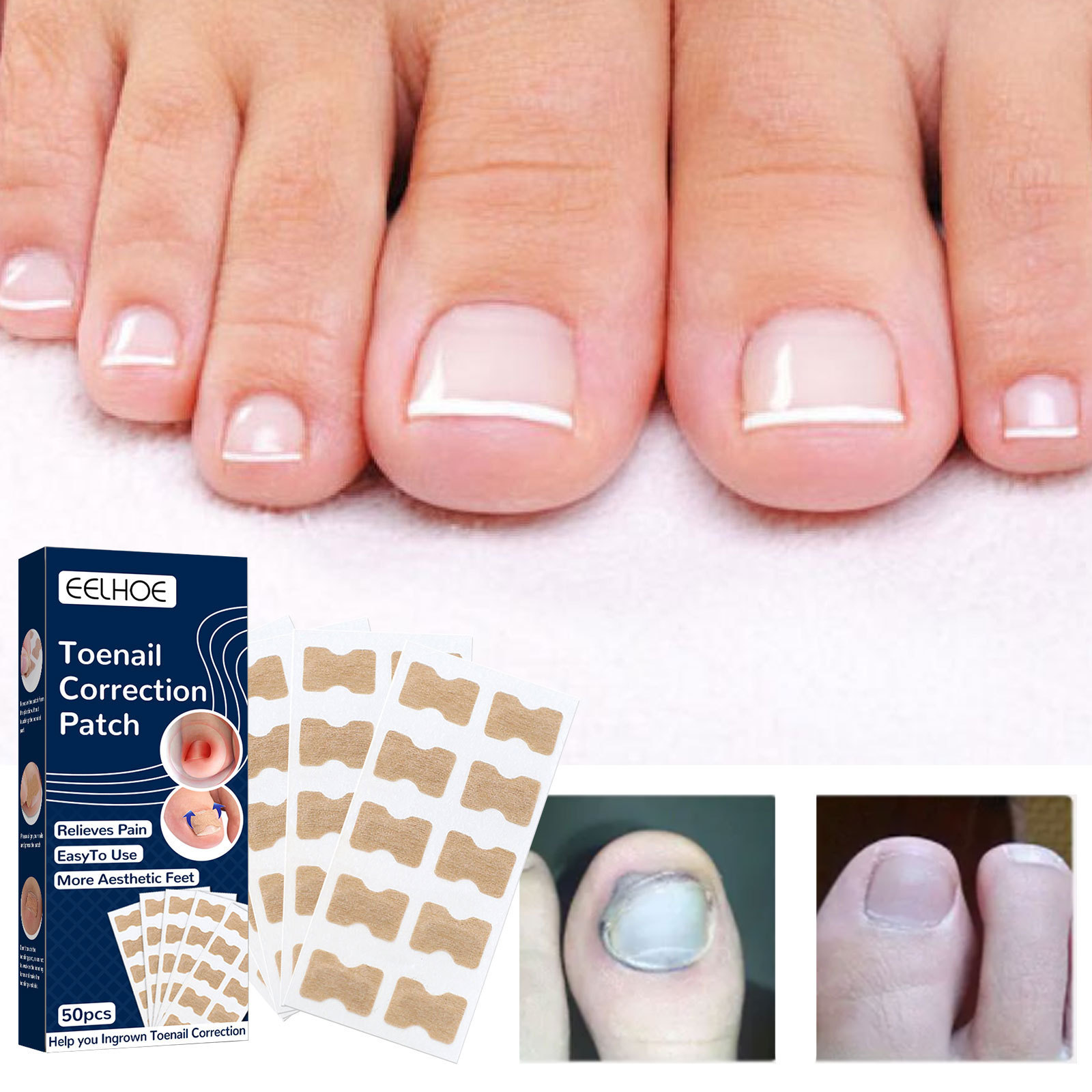 Nail correction patch for manicure and toe repair 修护脚趾 服饰配件/皮带/帽子/围巾 后跟贴 原图主图