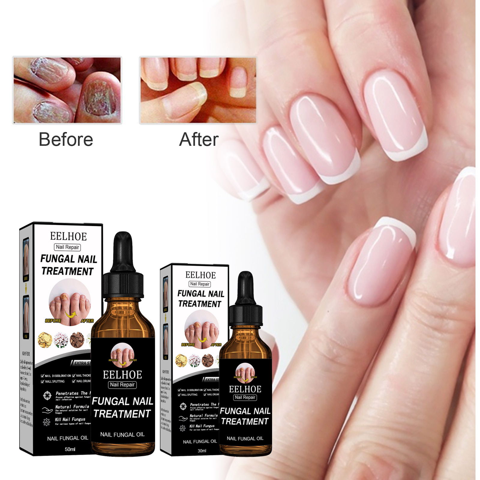 EELHOE 指甲修护亮甲营养液 增厚去灰指甲死皮修护滋润美甲护理液