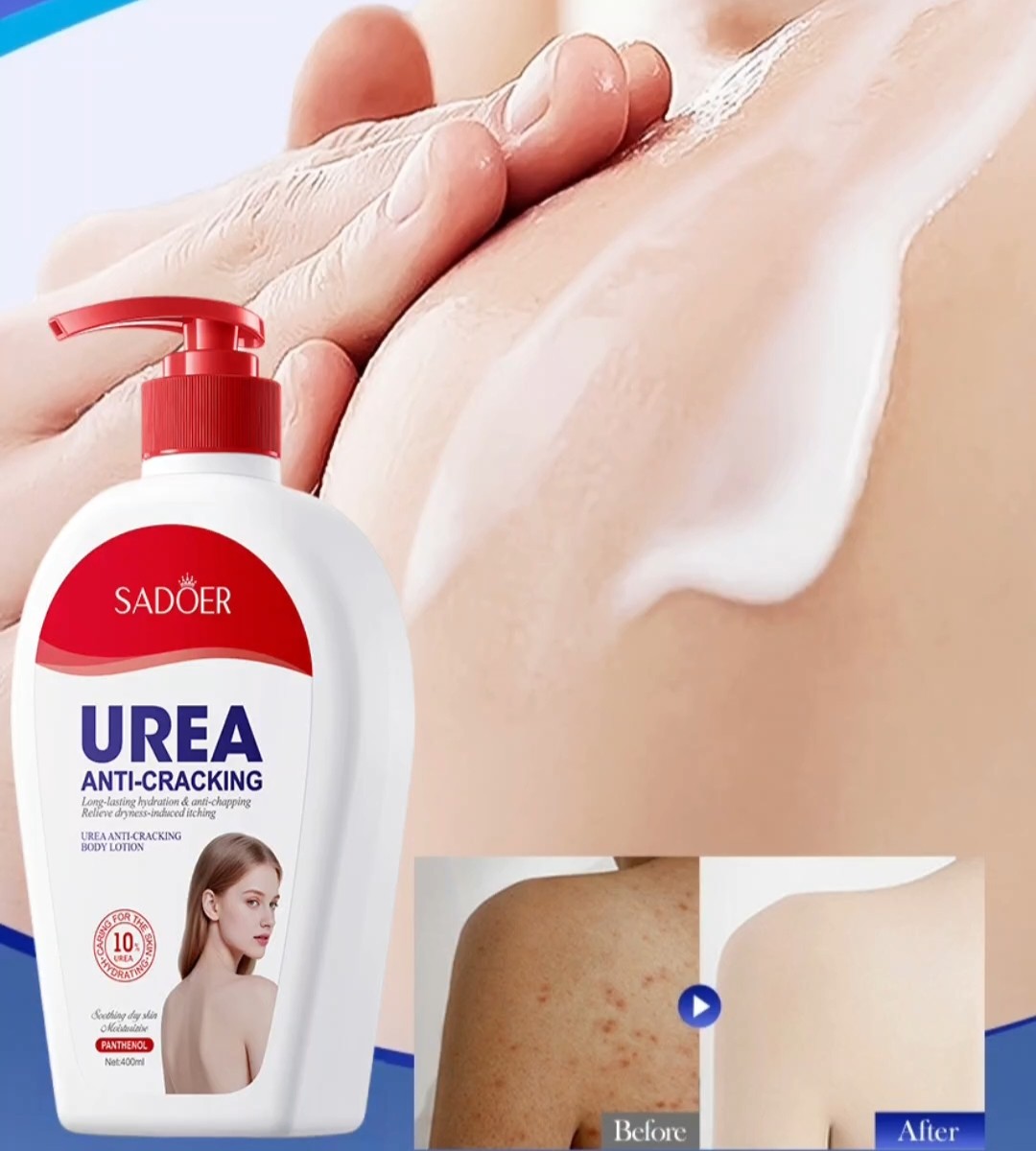 尿素滋润身体乳400滋润保湿防干裂Urea Moisturizing Body Lotion图片