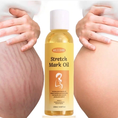 Stretch Marks oil 妊娠纹油120ml 按摩精油 采词