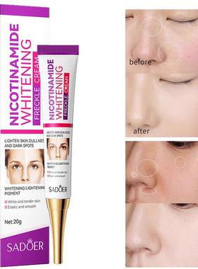 Nicotinamide Whitening Dark Spots Cream Freckle Removal Brig