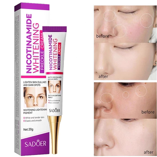 Nicotinamide Whitening Dark Spots Cream Freckle Removal Brig
