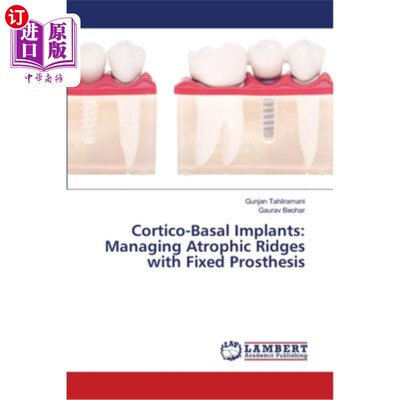 海外直订医药图书Cortico-Basal Implants: Managing Atrophic Ridges with Fixed Prosthesis 皮质基底种植体:用固定假体处