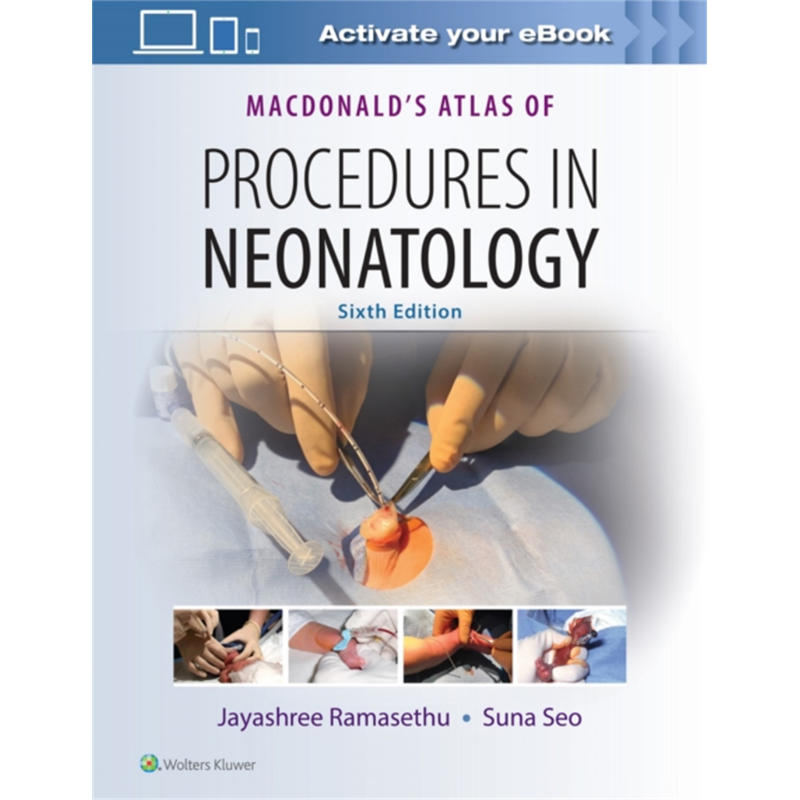 现货 MacDonald新生儿操作图解 第6版 MacDonalds Atlas of Procedures in Neonatology 英文原版 Jayashree R【中商原版】