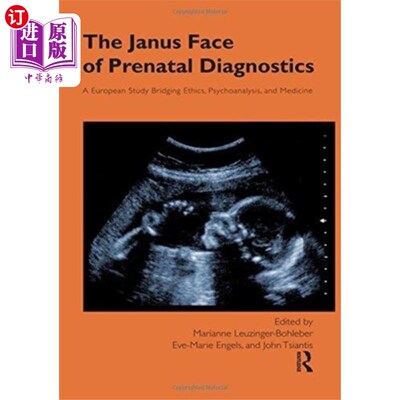 海外直订Janus Face of Prenatal Diagnostics 产前诊断的双面人