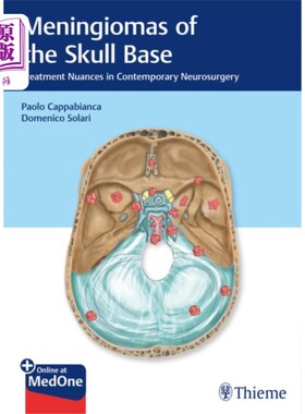 海外直订医药图书Meningiomas of the Skull Base 颅底脑膜瘤