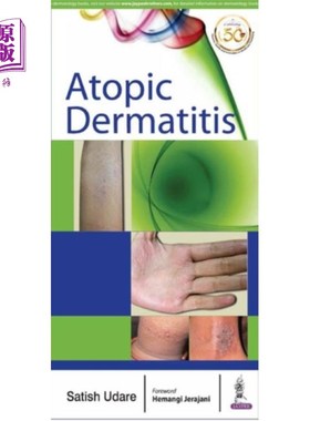 海外直订医药图书Atopic Dermatitis 特应性皮炎