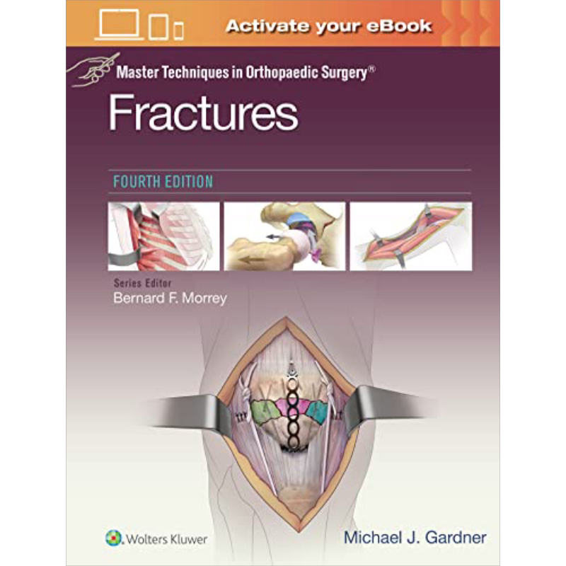 现货 掌握骨外科手术技术 骨折 第4版 Master Techniques in Orthopaedic Surgery 英文原版 Michael J Gardner 【中商原版】