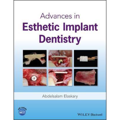 现货 美学植入牙科进展 Advances In Esthetic Implant Dentistry 英文原版 Abdelsalam Elaskary 中商原版