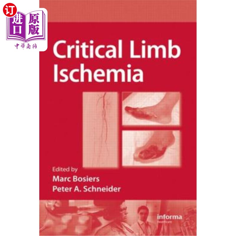 海外直订医药图书Critical Limb Ischemia 严重肢体缺血