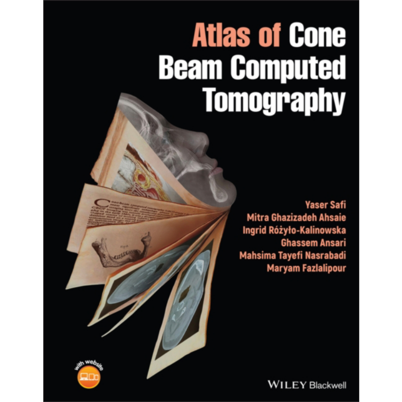 预售 锥束计算机断层扫描图谱 Atlas Of Cone Beam Computed Tomography 英文原版 Ghassem Ansari【中商原版】