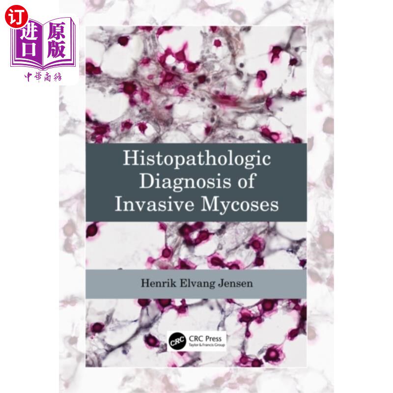 海外直订医药图书Histopathologic Diagnosis of Invasive Mycoses 侵袭性真菌病的组织病理学诊断