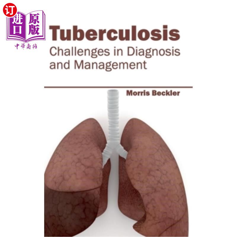 海外直订医药图书Tuberculosis: Challenges in Diagnosis and Management 结核病：诊断和管理的挑战