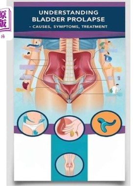 海外直订医药图书Understanding Bladder Prolapse - Causes, Symptoms, Treatment: Bladder prolapse h 了解膀胱脱垂的原因