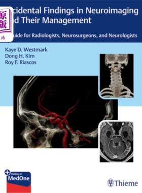海外直订医药图书Incidental Findings in Neuroimaging and Their Management: A Guide for Radiologis 神经影像学的偶然发