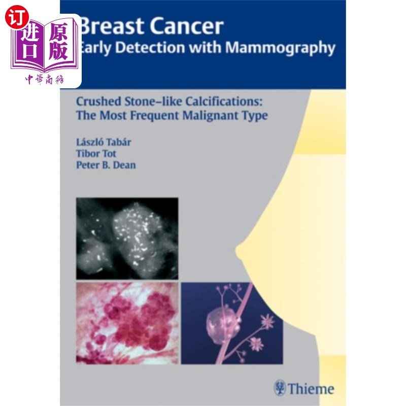 海外直订医药图书Breast Cancer: Early Detection with Mammography 乳腺癌:乳房x光检查的早期发现