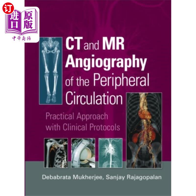 海外直订医药图书CT and MR Angiography of the Peripheral Circulat... 外周循环的CT和MR血管造影