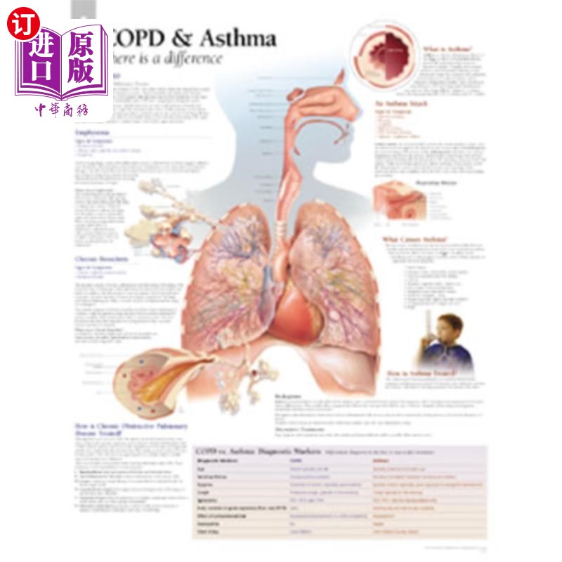 海外直订医药图书Copd/Asthma Chart: Wall Chart Copd/哮喘图表：挂图