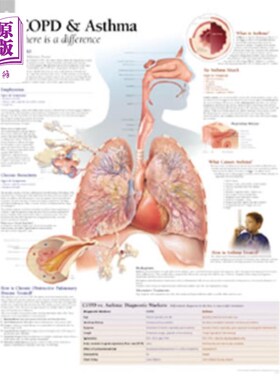 海外直订医药图书Copd/Asthma Chart: Wall Chart Copd/哮喘图表：挂图