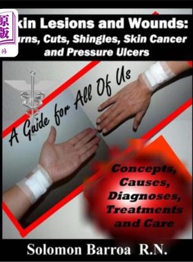 海外直订医药图书Skin Lesions and Wounds: Burns, Cuts, Shingles, Skin Cancer and Pressure Ulcer:  皮肤损伤和伤口：烧