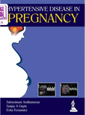 海外直订医药图书Hypertensive Disease in Pregnancy 妊娠期高血压病