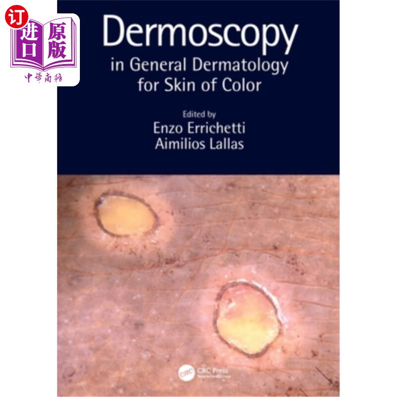 海外直订医药图书Dermoscopy in General Dermatology for Skin of Color 普通皮肤科有色皮肤的皮肤镜检查