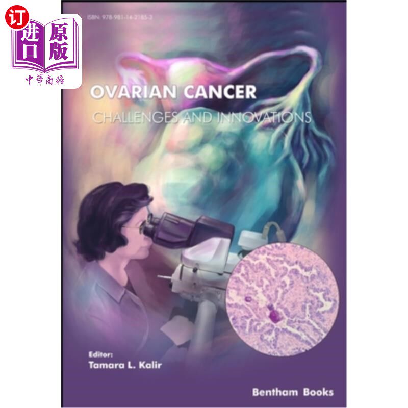 海外直订医药图书Ovarian Cancer - Challenges & Innovations 卵巢癌-挑战与创新