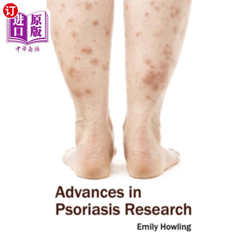 海外直订医药图书Advances in Psoriasis Research 银屑病研究进展