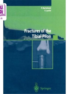 海外直订医药图书Fractures of the Tibial Pilon 胫骨皮隆骨折