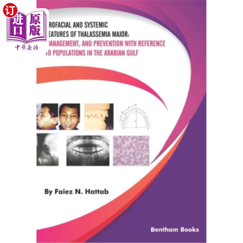 海外直订医药图书Orofacial and Systemic Features of Thalassemia Major: Management, and Prevention 重大地中海贫血的口