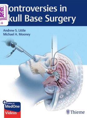 海外直订医药图书Controversies in Skull Base Surgery 颅底手术的争议