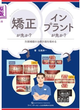 海外直订日语 矯正が先か？インプラントが先か？　欠損補綴の治療計画を極める 先矫正吗?种植牙先吗?把缺损补牙的治疗计划