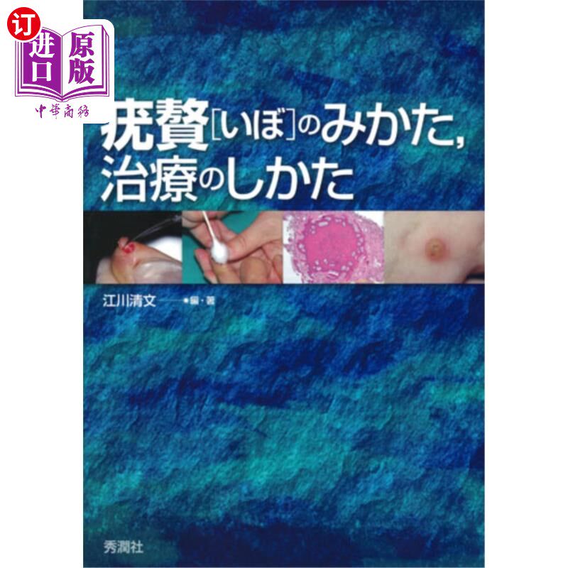 海外直订日语 疣贅（いぼ）のみかた，治療のしかた 怎么看疣，怎么治疣