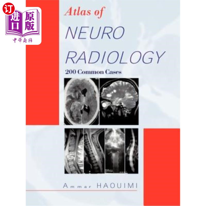 海外直订医药图书Atlas of Neuroradiology: 200 Common Cases 神经放射图谱：200例常见病例