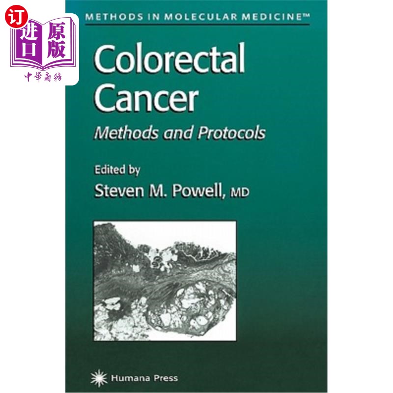 海外直订医药图书Colorectal Cancer: Methods and Protocols 结直肠癌：方法和方案