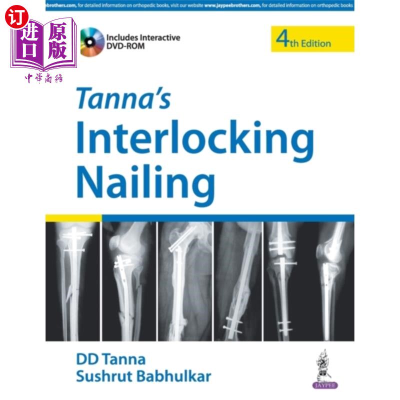 海外直订医药图书Tanna's Interlocking Nailing 坦娜的连锁钉