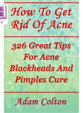海外直订医药图书How To Get Rid Of Acne: 326 Great Tips For Acne Blackheads And Pimples Cure 如何摆脱痤疮:326个伟大