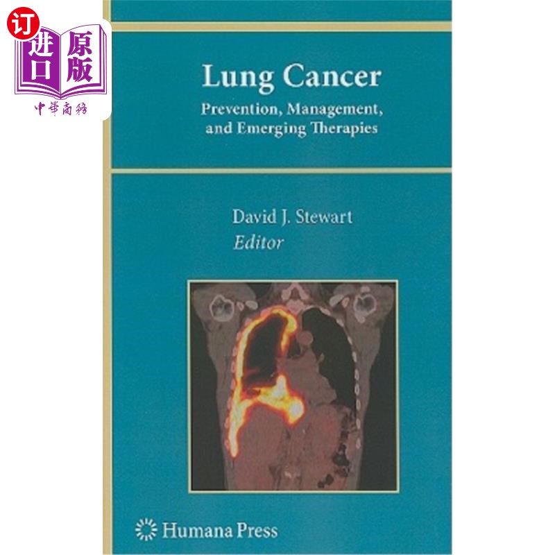 海外直订医药图书Lung Cancer:: Prevention, Management, and Emerging Therapies 肺癌:预防、管理和新兴疗法。