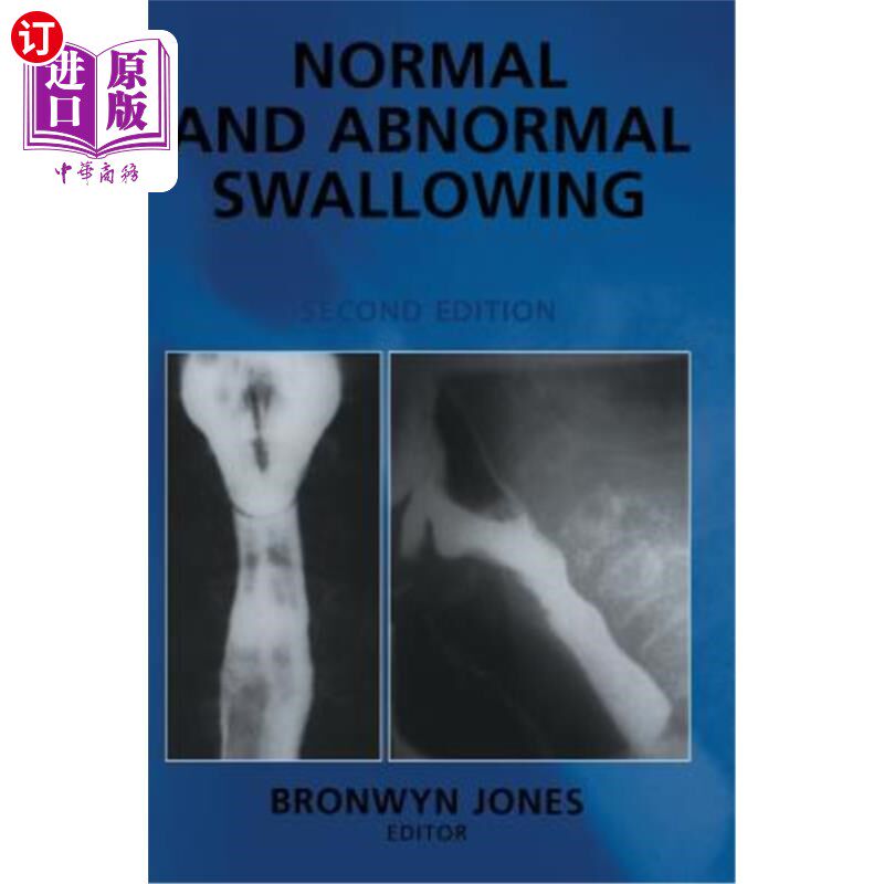 海外直订医药图书Normal and Abnormal Swallowing: Imaging in Diagnosis and Therapy 正常和异常吞咽:影像学在诊断和治疗
