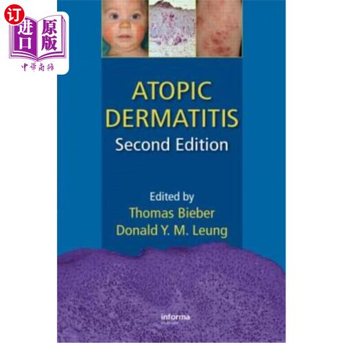 海外直订医药图书Atopic Dermatitis 特应性皮炎