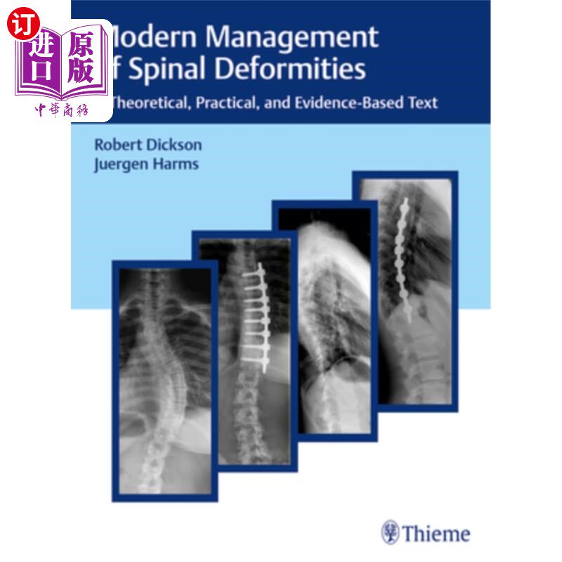 海外直订医药图书Modern Management of Spinal Deformities: A Theoretical, Practical, and Evidence- 脊柱畸形的现代管理