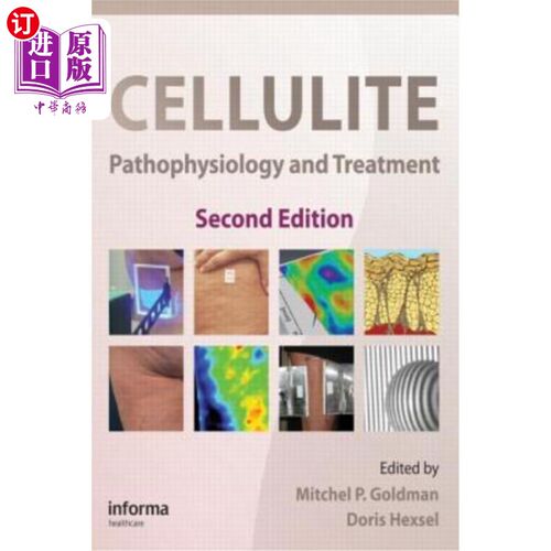 海外直订医药图书Cellulite: Pathophysiology and Treatment 脂肪团:病理生理与治疗