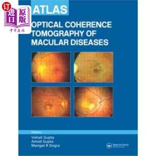 海外直订医药图书Atlas of Optical Coherence Tomography of Macular Diseases 黄斑病变光学相干层析成像图谱