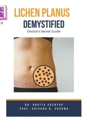 海外直订医药图书Lichen Planus Demystified Doctors Secret Guide 扁平苔藓揭秘医生秘密指南