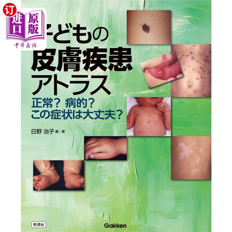 海外直订日语 子どもの皮膚疾患アトラス　正常？病的？この症状は大丈夫？ 儿童皮肤疾病atlas正常吗?病态?这个症状不要紧吗