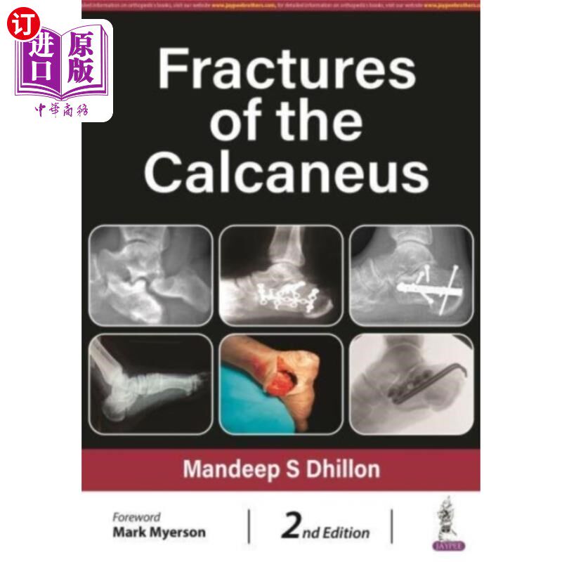 海外直订医药图书Fractures of the Calcaneus 跟骨骨折