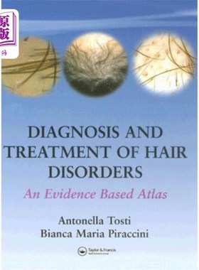 海外直订医药图书Diagnosis and Treatment of Hair Disorders: An Evidence-Based Atlas 头发疾病的诊断和治疗:一个循证图