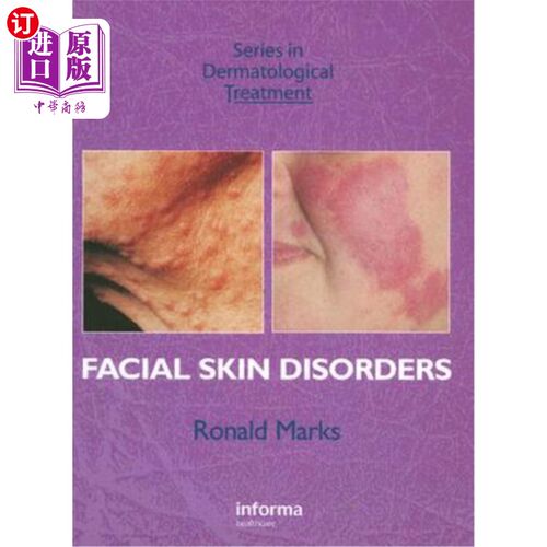 海外直订医药图书Facial Skin Disorders 面部皮肤病