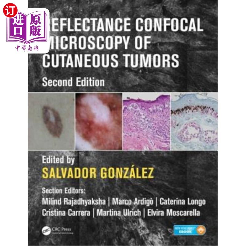 海外直订医药图书Reflectance Confocal Microscopy of Cutaneous Tumors 皮肤肿瘤的反射共聚焦显微镜